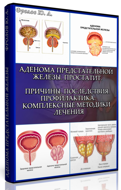 Мини инфопродукт №4 «Аденома предстательной железы_0.png